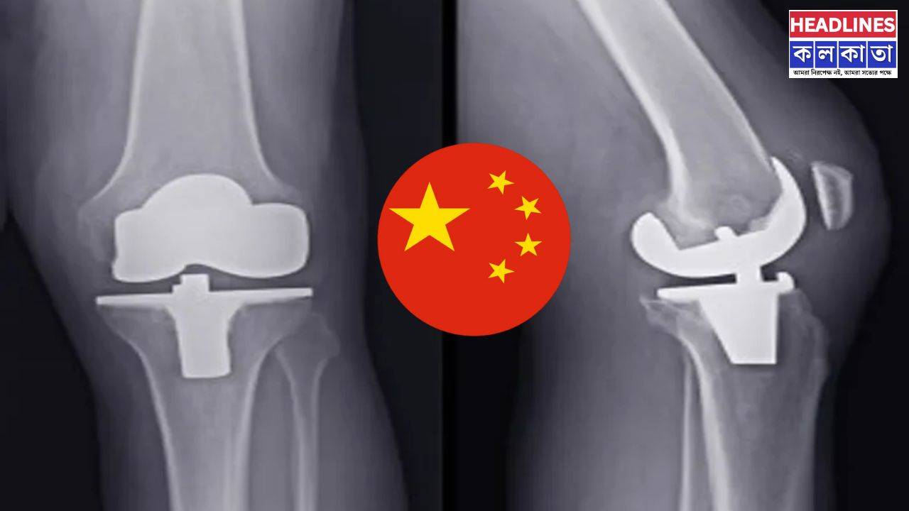 যুগান্তকারী আবিষ্কার চীনের, মাত্র ৩ মিনিটে ভাঙা হাড় জোড়া যাবে এবার! 